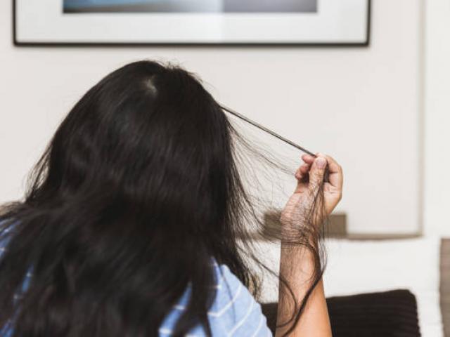 Trichotillomanie l'hypnose peut vous aider à arrêter de vous arracher les cheveux Trichotillomanie l'hypnose peut vous aider à arrêter de vous arracher les cheveux